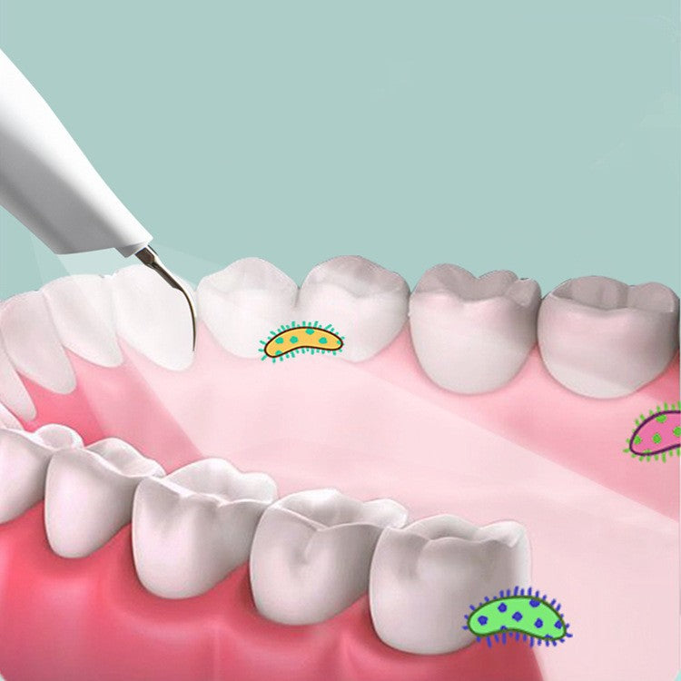 Ultrasonic Dental Cleaner for Home Use